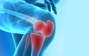 kako se kaže artroza kolenskega sklepa