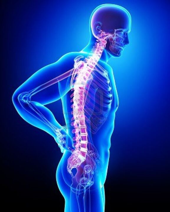Osteohondroza prizadene človeško hrbtenico