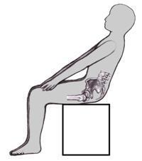 bolečine v hrbtu tailbone pri ženskah